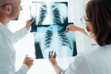 Erkek doktor ve genç bayan meslektaşım hastanedeki radyoloji bölümünde hastanın göğüs röntgeni film ciğerlerini tarıyor. Covid-19 xray testi, covid dünya çapında virüs salgını konsept görüntü yayıyor.