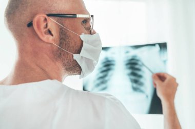 Hastanenin radyoloji bölümünde hastanın göğüs röntgeni film ciğerlerini inceleyen olgun erkek doktor portresi. Covid-19 Dünya çapında virüs yayılımı konsepti için vücut röntgeni taraması..
