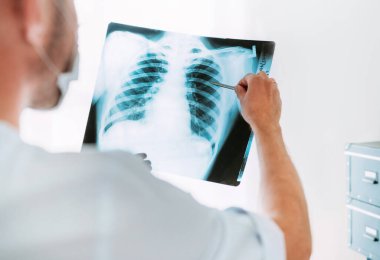 Hastanedeki radyoloji bölümünde hastanın göğüs röntgeni film ciğerlerini inceleyen erkek doktor. Covid-19 dünya çapında virüs salgını konsepti için vücut röntgeni taraması..