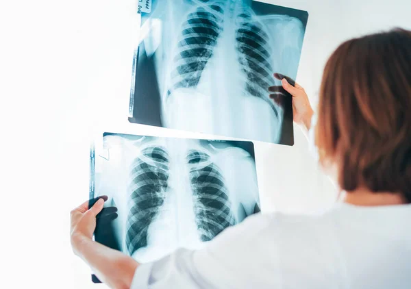 Female doctor comparing two patient's chest x-ray film lungs scans at radiology department in hospital.Lung disorders or Covid-19 scan lungs xray detection. Covid  virus epidemic spread concept.