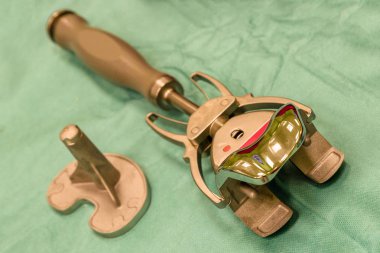 Diz endoprotezi implantı. 