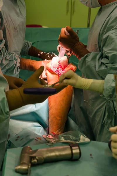 Surgery bij Operating theater — Stockfoto