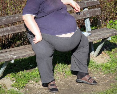 Obezite. Koca göbekli şişko XXL adam oturuyor.