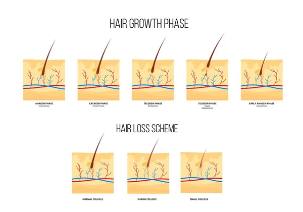 Esquema de etapas de pérdida de cabello humano y fase de crecimiento de estilo plano — Vector de stock