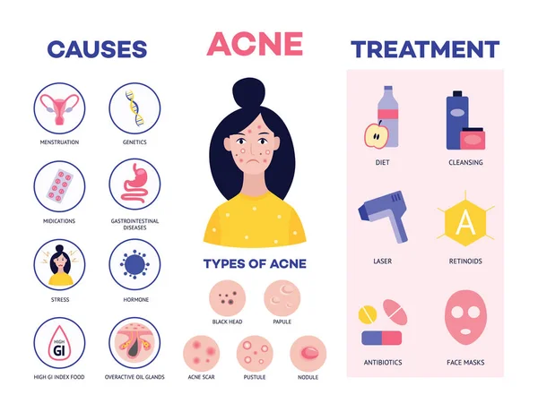 Affiche montrant les causes et les méthodes de traitement de l'acné vecteur plat illustration . — Image vectorielle