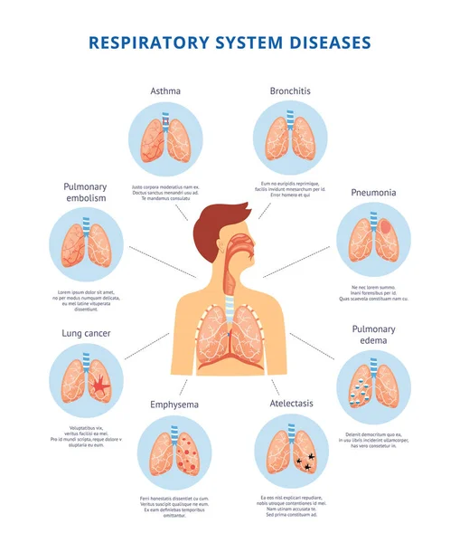 Human respiratory system diseases informative diagram vector illustration. — Stock Vector