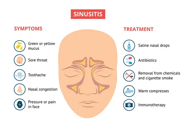 Sinusite respiratoria sintomi e trattamento banner medico vettoriale illustrazione . — Vettoriale Stock