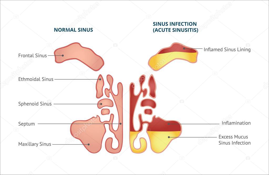 Medical infographic of sinus and human nasal anatomy.