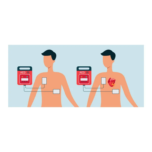 Automated external defibrillator with human and man body, aed concept for heart. — Stock Vector
