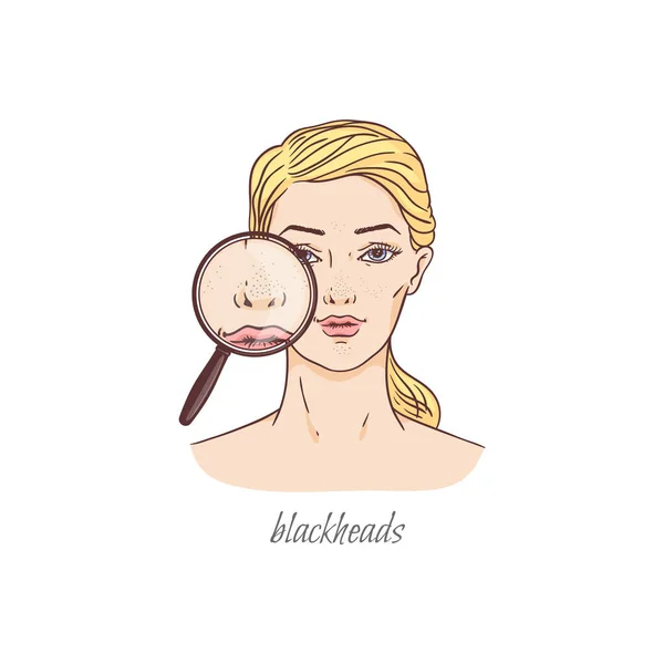 Nose blackheads in looking glass - wanita pirang dengan masalah kondisi kulit - Stok Vektor