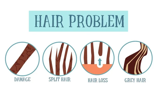 Afiche conjunto de problemas de cabello - daños en la salud del cabello, puntas abiertas, caídas — Vector de stock