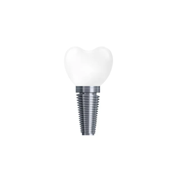 白い背景に隔離された歯科インプラント-現実的な白いセラミック歯 — ストックベクタ