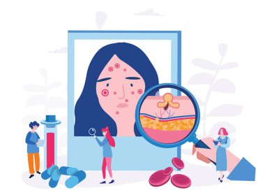 akne problemiyle uğraşan dermatologların çizgi film vektör çizimi