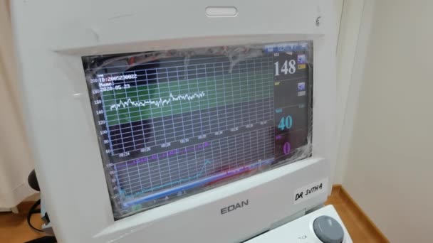 Kota Kinabalu Sabah Malaysia Mai 2020 Diagramm Schwangere Mit Elektrokardiographischer — Stockvideo