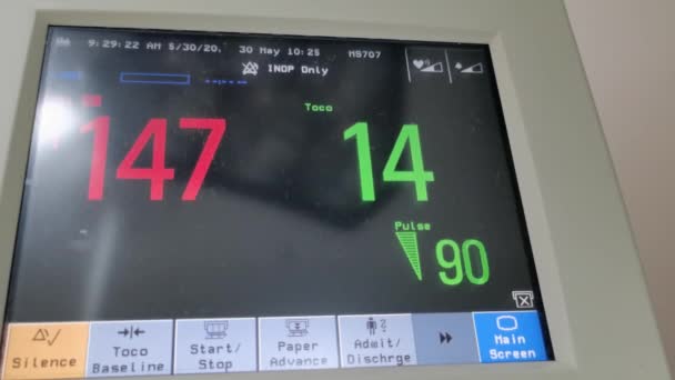 Kota Kinabalu Sabah Malezja Maj 2020 Monitor Diagramu Kobieta Ciąży — Wideo stockowe