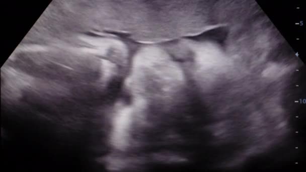 Μικρό Μωρό Είναι Κατά Διάρκεια Εβδομάδων Στροφή Στην Κοιλιά Της — Αρχείο Βίντεο