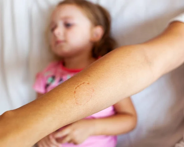 Toddler female biting the arm of the mother. — Stock Photo, Image