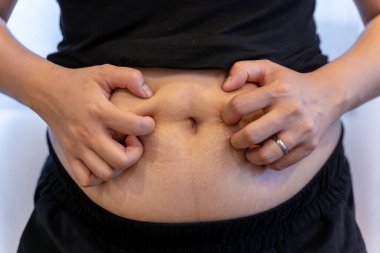 Asian woman squeezing her belly fat, concept of weight loss, healthy diet, body care, and fitness lifestyle.