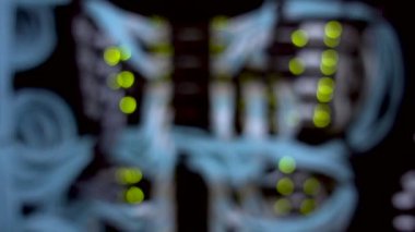  Optik sunucu. Komütatör. yanıp sönen ışıklar. Fiber optik. Bilgisayar bir rafa büyük veri merkezi koparan