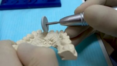 Diş teknisyeni diş implats yapıyor. Ellerini kapatın. Diş Laboratuvarı diş hazırlık. 
