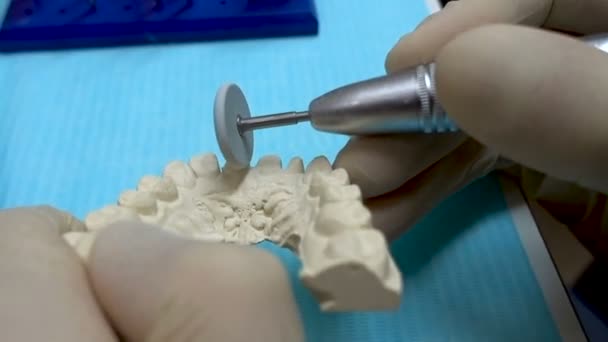 Técnico Dentário Está Fazer Implantes Dentários Mãos Fechadas Preparação Dentária — Vídeo de Stock