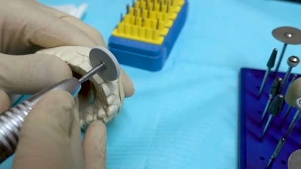 Odontotecnico Sta Facendo Implatare Denti Chiudi Mani Preparazione Dentale Laboratorio — Video Stock