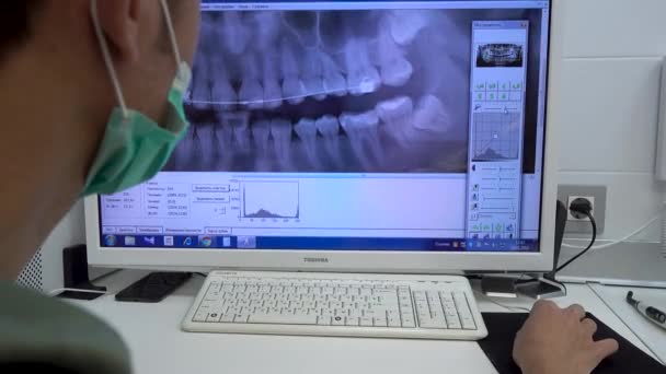 ロシア モスクワ 2019 歯科医はコンピューターで顎のパノラマ撮影を探しています 歯科医院 ビデオにモアレがあります — ストック動画