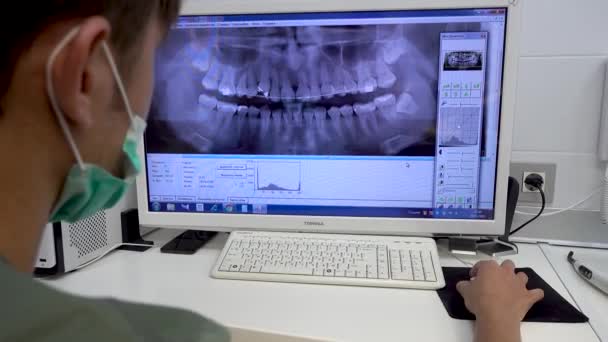 Russia Mosca Gennaio 2019 Dentista Sta Guardando Una Foto Panoramica — Video Stock