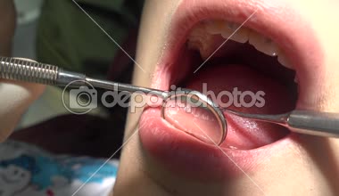 Diş hekimi ortodontist maloklüzyon düzeltilmesi ziyaret edin. Metal diş telleri yakın çekim.