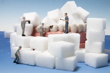 Zahnbehand lung Baustelle Karies Loch im Zahn