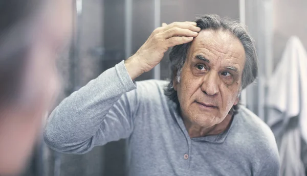 Viejo Está Comprobando Pérdida Cabello — Foto de Stock