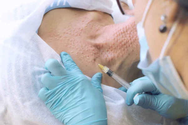 Cosmetologista Injeta Paciente Pescoço Visão Primeira Pessoa Close — Fotografia de Stock