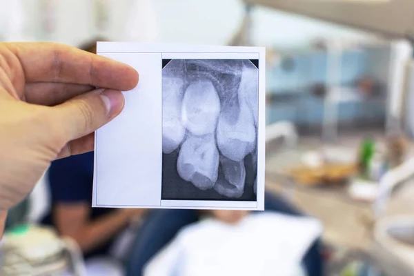 Çocuğun diş el x-ışını fotoğrafı