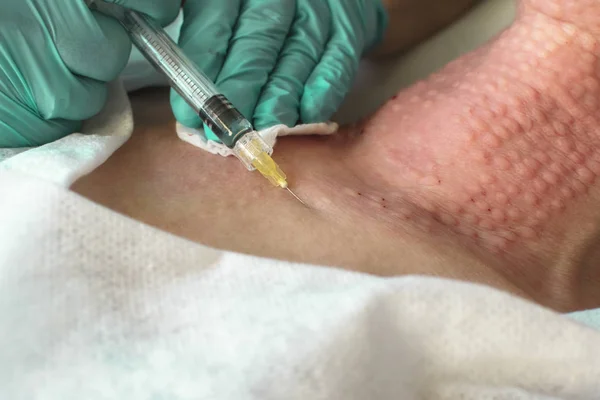 Eldivenli bir güzellik doktorunun elleri bir kadının boynuna yaşlanma karşıtı sıvı enjekte eder. Güzellik konsepti. Closeup.