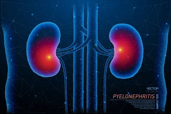 Abstract polygonal light of lungs inflammation structure. — Stock Illustration Abstract polygonal light of lungs inflammation structure. Vector Graphics