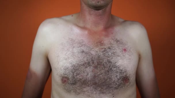 Primer plano del pecho peludo masculino. Parte del cuerpo con pelo . — Vídeo de stock