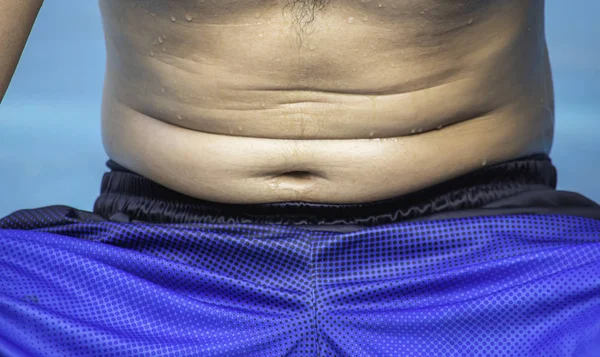 The belly skin men with excess fat. — Stock Photo, Image