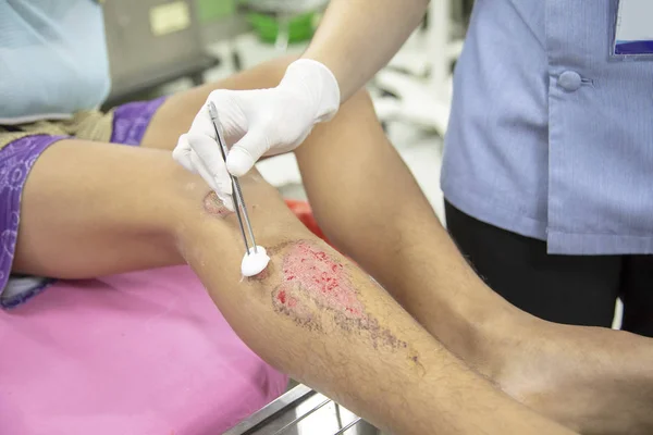 bir hemşire hastanın yara temiz