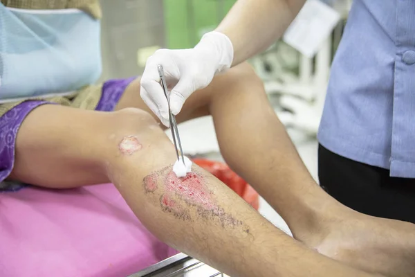 bir hemşire temizlik yara