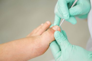 Doktor-Podiatry araçları ile