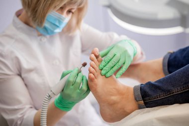 the podiatrist treats foot. clipart