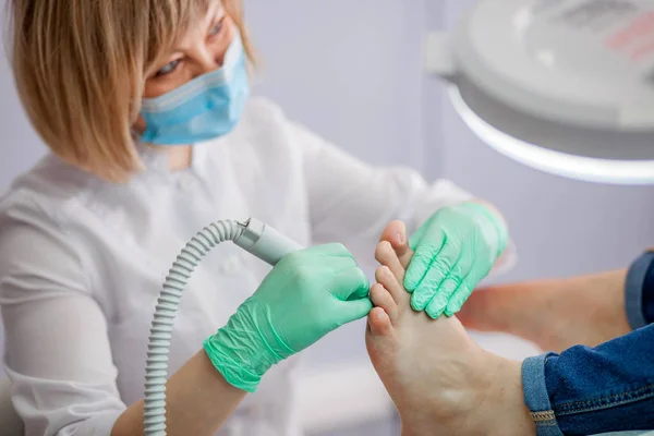 Podiatry Doctor Treatment Feet Nails — Stock Photo, Image