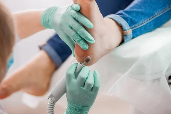 Médico Podologia Tratamento Pés Unhas — Fotografia de Stock