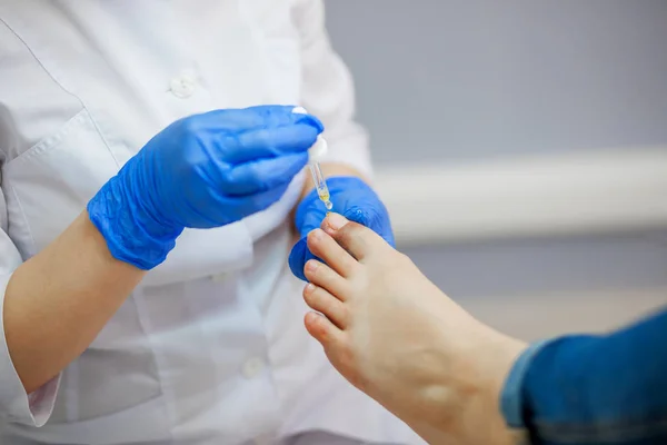 Podiatrie Doktor Ošetření Nohou Nehtů — Stock fotografie