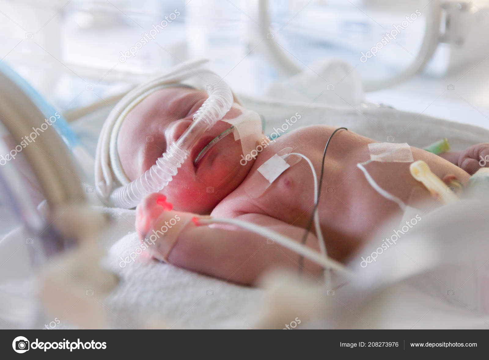 premature baby in incubator