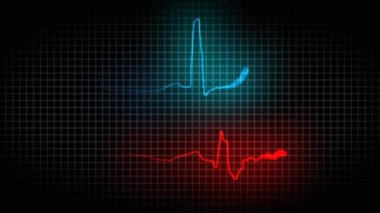 Kalbin hasta ve sağlıklı kardiyogram okuma. EKG. Sağlıklı ve hasta kalp 38