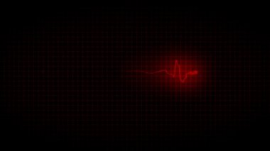 EKG kardiyogram kötü kalp hastalığı 32.