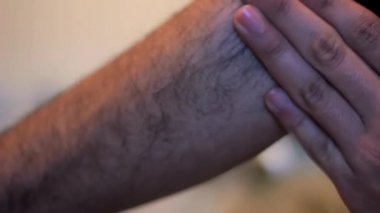 Kıllı kolunu eliyle ovuşturan bir adam.