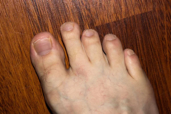 The toes of the right foot on the background of the laminate.