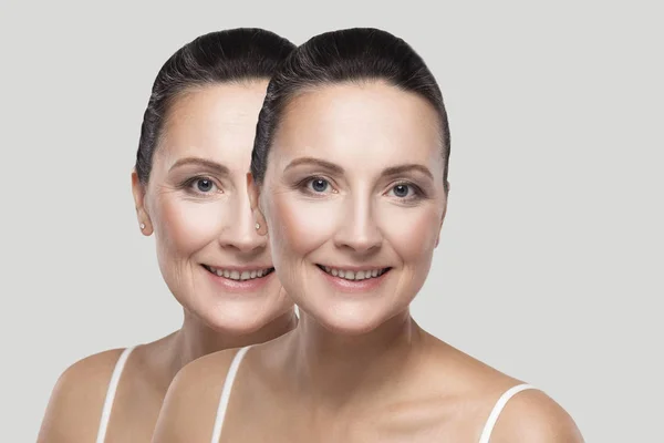 Faces Middle Aged Brunette Woman Beauty Skin Wrinkles Treatment Procedure — Stock Photo, Image